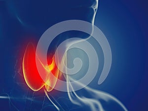 A mans thyroid gland