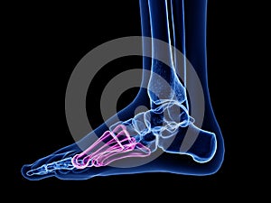 The metatarsal bone