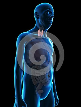 An old mans thyroid gland