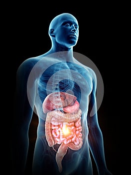 A painful digestive system photo