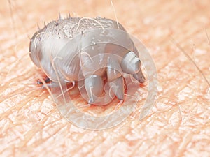 A scabies mite photo