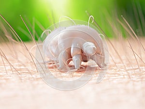 a scabies mite photo