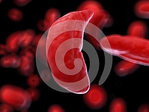 Sickle cells photo