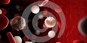 too many white blood cells due to leukemia