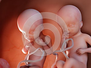 Twin fetuses - week 25