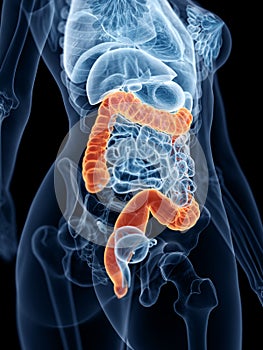 A womans large intestine photo