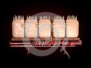 3d Rendering of leaky gut, in intestine with celiac disease and gluten sensitivity these tight junctions come apart. photo