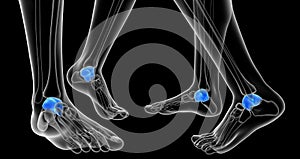 3d rendering of the malleolus bone