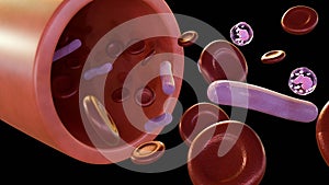 3d rendering of Septicemia, or sepsis by Klebsiella spp. bacteria photo