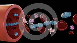 3d rendering of Septicemia, or sepsis by Streptococcus pyogenes photo
