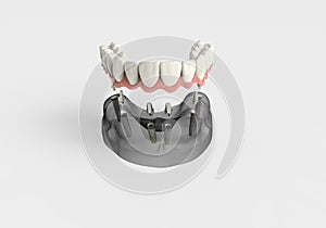 3D rendering teeth photo