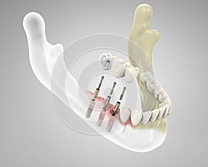 3D rendering teeth