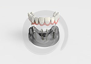 3D rendering teeth
