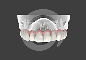 3D rendering teeth
