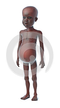 3d Starving African child side view photo