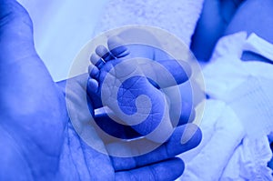 Dad holds legs in the palms of her hands. Newborn child baby having a treatment for jaundice under ultraviolet light in