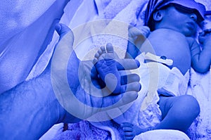 Dad holds legs in the palms of her hands. Newborn child baby having a treatment for jaundice under ultraviolet light in incubator