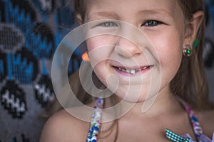 Dairy tooth fell out of the child. Little girl wobble loose tooth