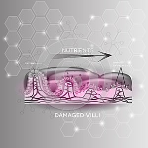 Damaged intestinal villi