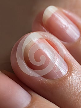 Damaged nails after gel polish. Close up. photo