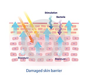 Structure of damaged skin barrier vector illustration isolated on white background. photo