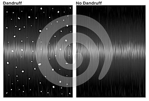 Dandruff hair and good hair , before and after