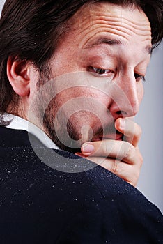 Dandruff issue on man's sholder photo