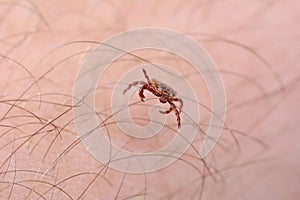 Danger of tick bite. Mite on the skin.