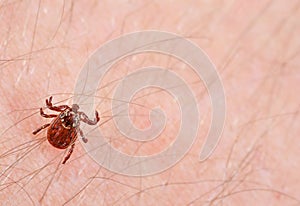 Danger of tick bite. Mite on the skin.