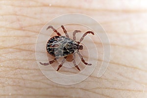 Dangerous blood-sucking insect. small brown spotted mite, biological name Dermacentor marginatus on human skin. macrophoto