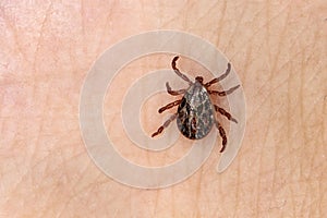 dangerous blood-sucking insect. small brown spotted mite, biological name Dermacentor marginatus on human skin. Tick on the skin