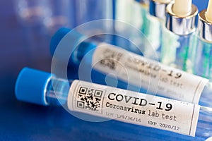 Dangerous coronavirus Covid-19 virus in a laboratory - infection of 2019-nCoV virus.  Global pandemic risk due to coronavirus