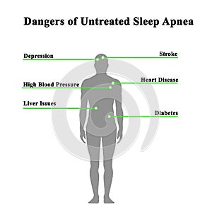 Untreated Sleep Apnea