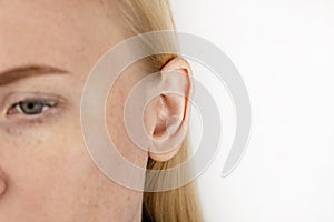 Darwin`s tubercle on the ear. The girl at the reception at the plastic surgeon, shows the auricle