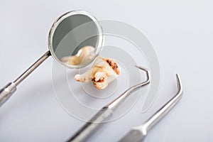 Decay Tooth With Dental Tools