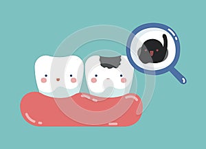 Decayed tooth and bacteria , tooth and teeth of dental concept photo