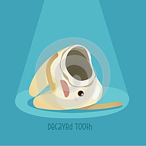 Decayed tooth photo