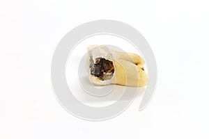 Decayed tooth on white background