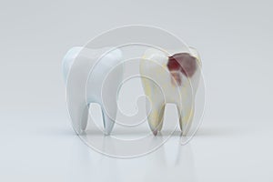 The decayed tooth beside with the white tooth, 3d rendering