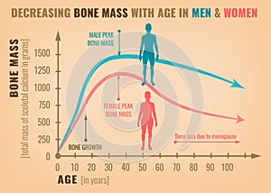 Decreasing bone mass photo