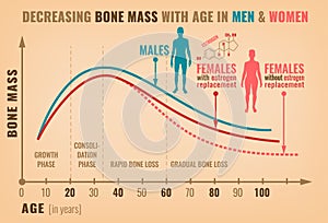 Decreasing bone mass photo