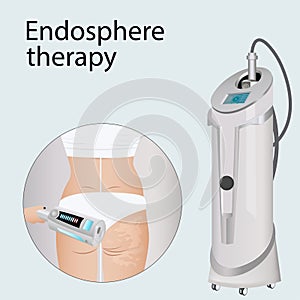 Deep cellulite reduction Body contouring Lifting with Endospheres apparatus. Physiotherapy, lymphatic