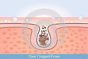 Deep cleaning unclog pores. photo