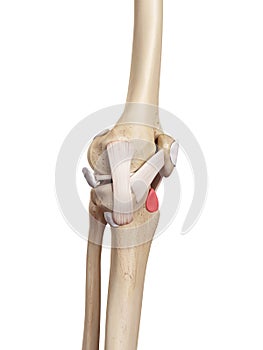 The deep infrapatellar bursa