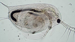 Defecation of the microorganism from daphnia pond close-up