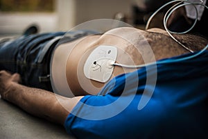 Defibrillator electrode photo