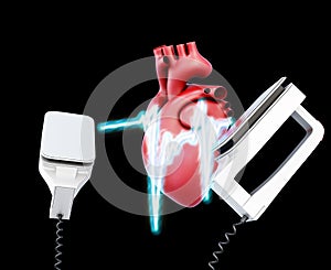 Defibrillator and heart on a black background.