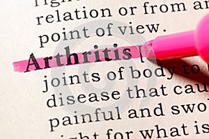 Definition of Arthritis