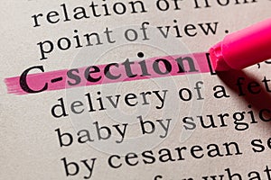 Definition of C-section photo