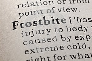 Definition of frostbite